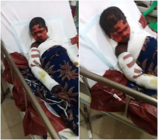 Unbelievable!! See What Happened To This Little Girl After Taking Injection From A Nurse (See Photos)